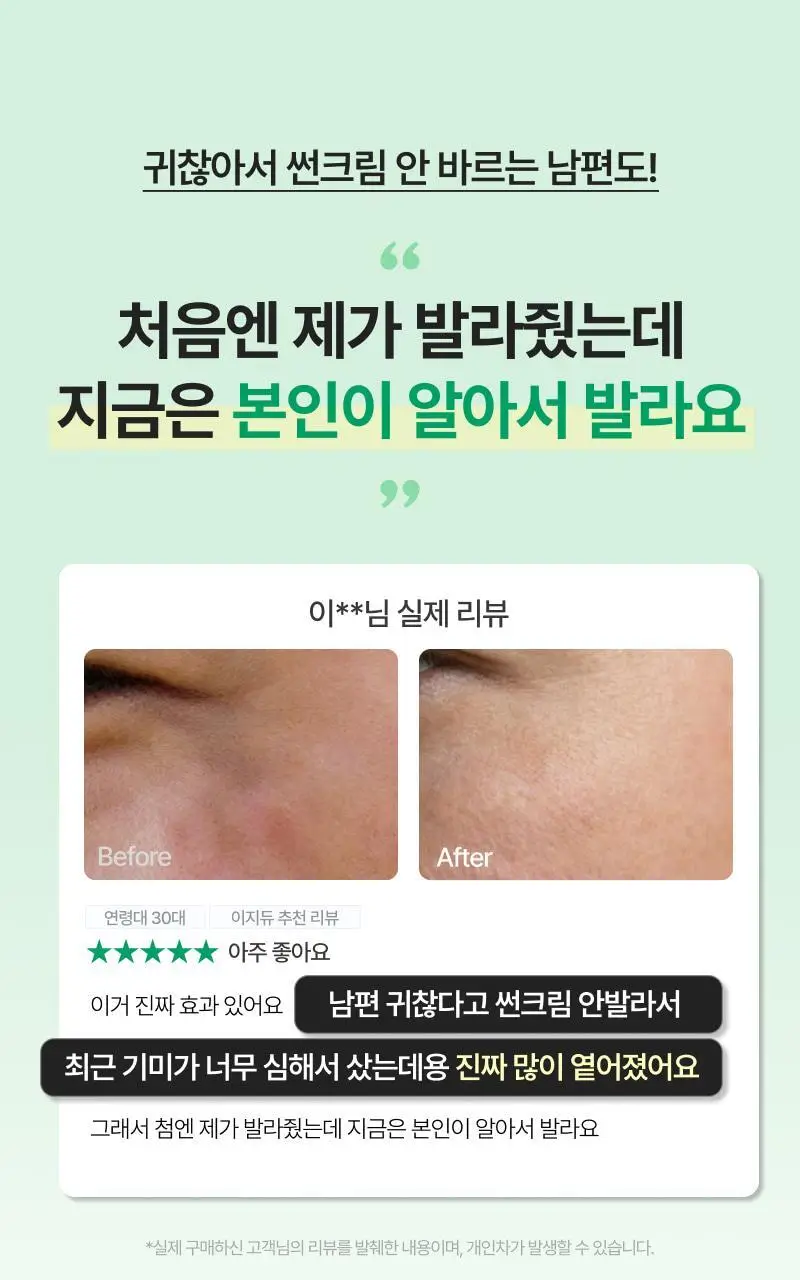 [기미개선] 대웅제약 이지듀 기미잡티앰플 12ml+1ml 기획 상세페이지 3